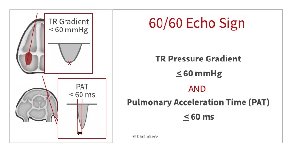 Specific Echo Parameters that Indicate Elevated LAP Cardioserv