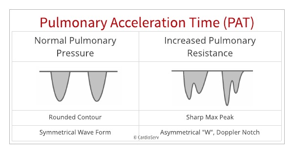 Specific Echo Parameters that Indicate Elevated LAP Cardioserv