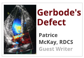 Gerbode’s Defect in Echocardiography