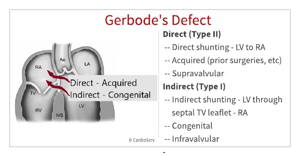 gerbode defect diagram