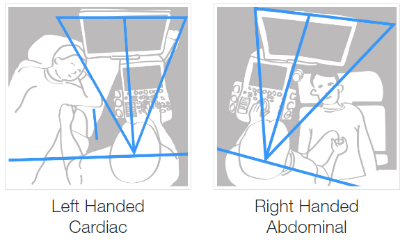 sonographer ergonomics