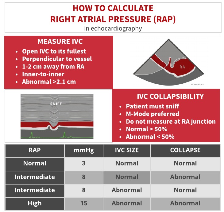 how to estimate right atrial pressure RAP