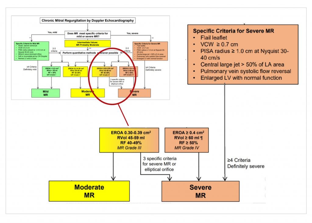 Grading MR Severity with Echo