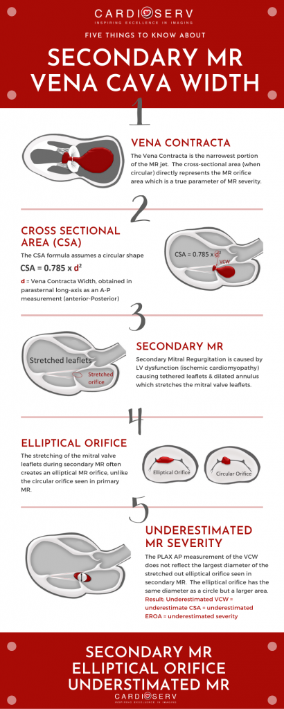 5 things to know about secondary MR and vena contracta width (VCW)