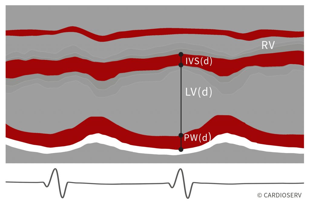 m-mode left ventricle