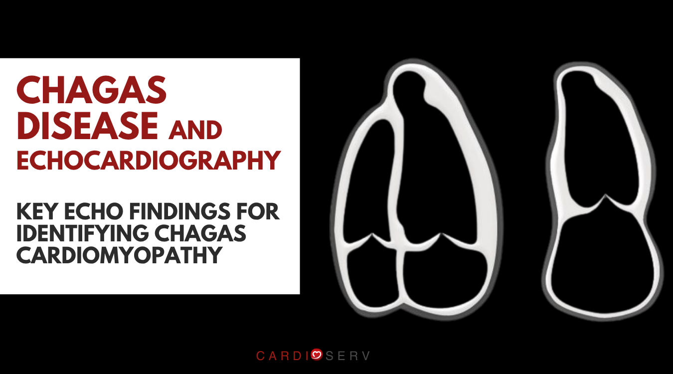 chagas disease in echocardiography