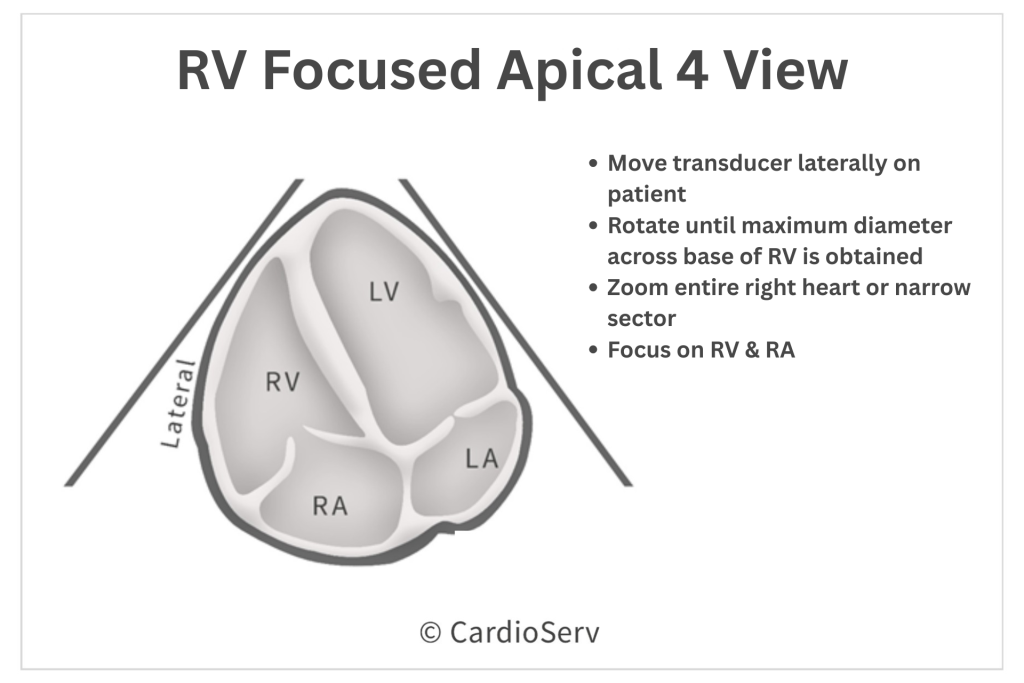rv focused apical four chamber echo view
