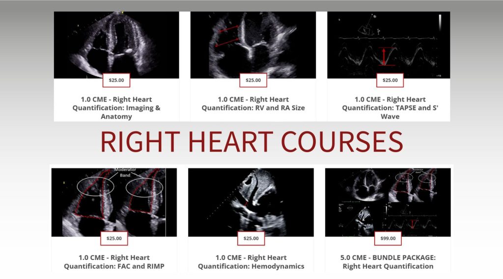 online echo CME right heart quantification in echocardiography