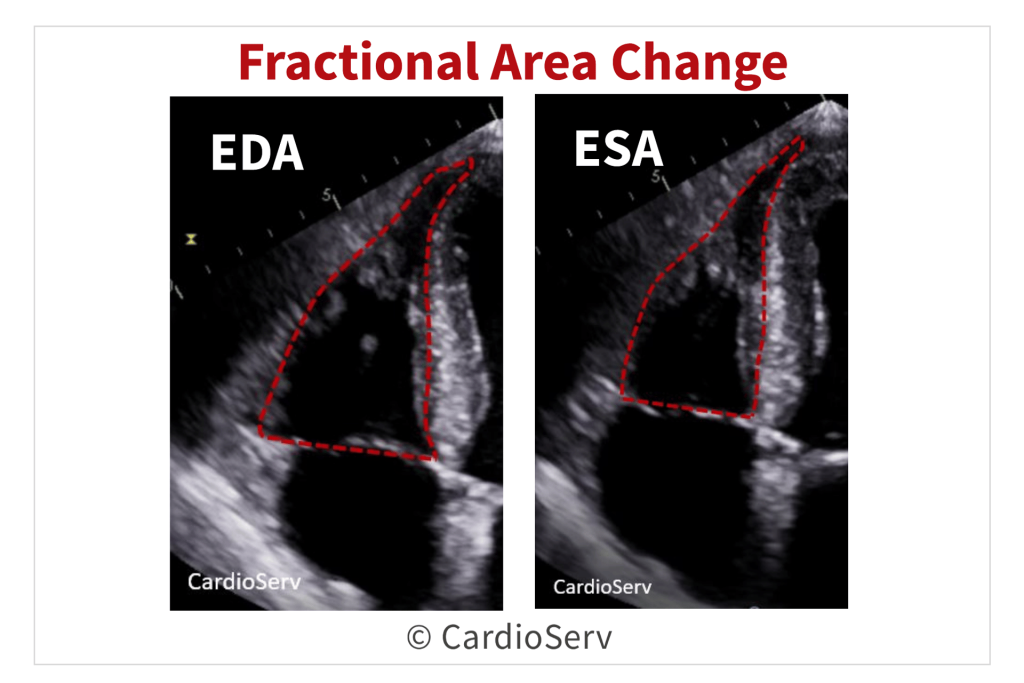 fractional area change