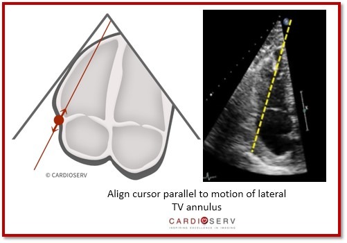 rv focused apical view tapse