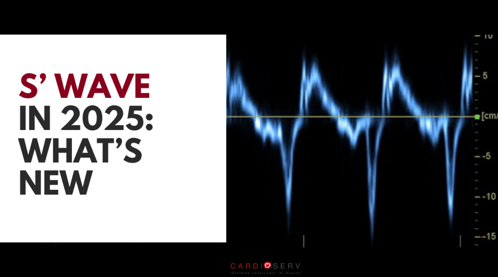 s' wave velocity echo