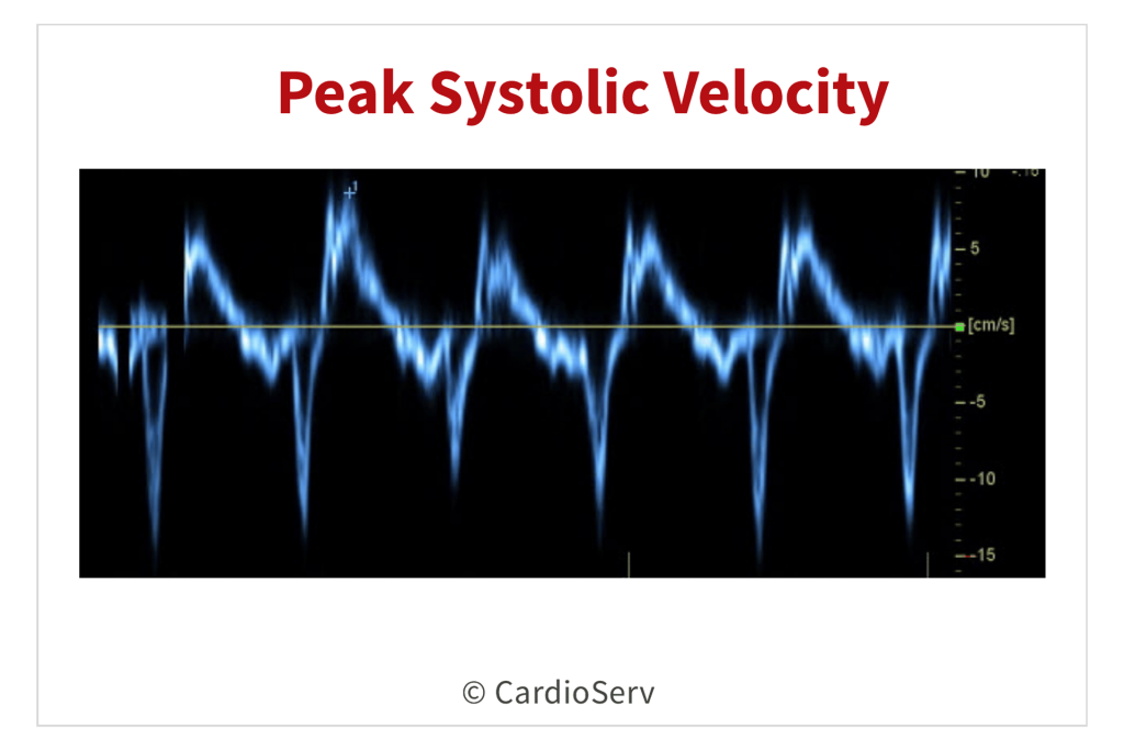 how to measure s' wave velocity echo