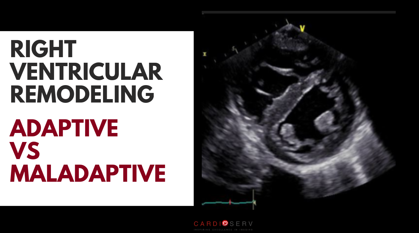 Adaptive vs Maladaptive Right Ventricular Remodeling