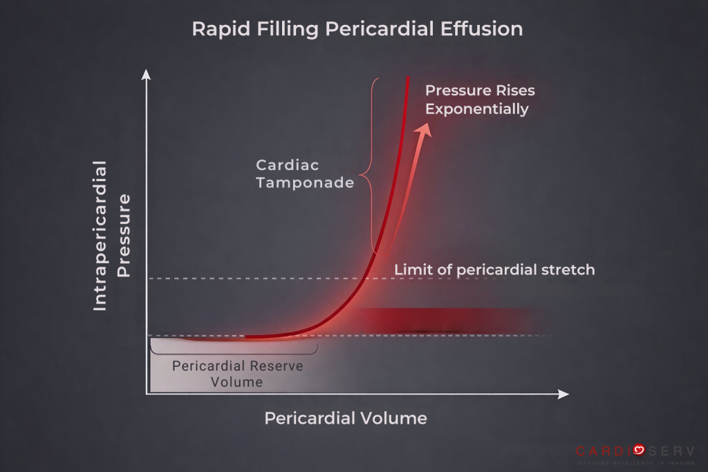 rapid filling pericardial effusion pressure curve