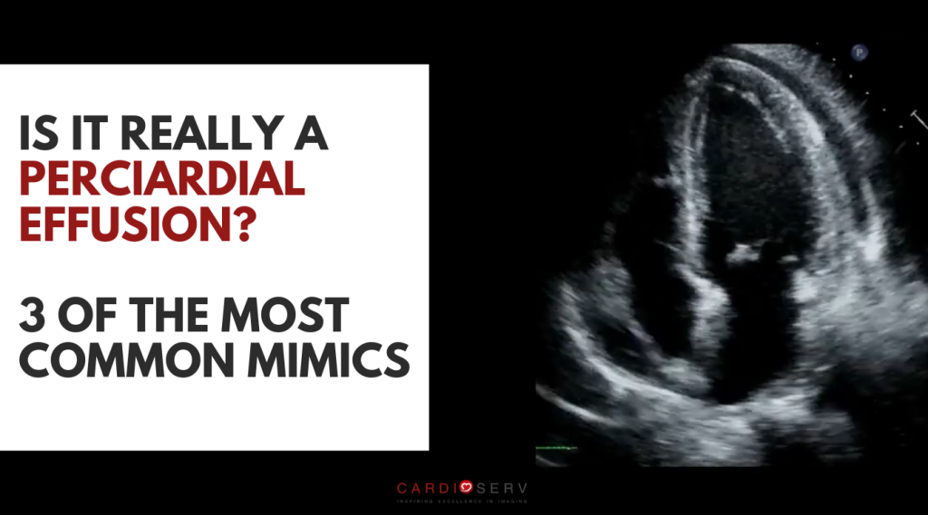 pericardial effusion mimics