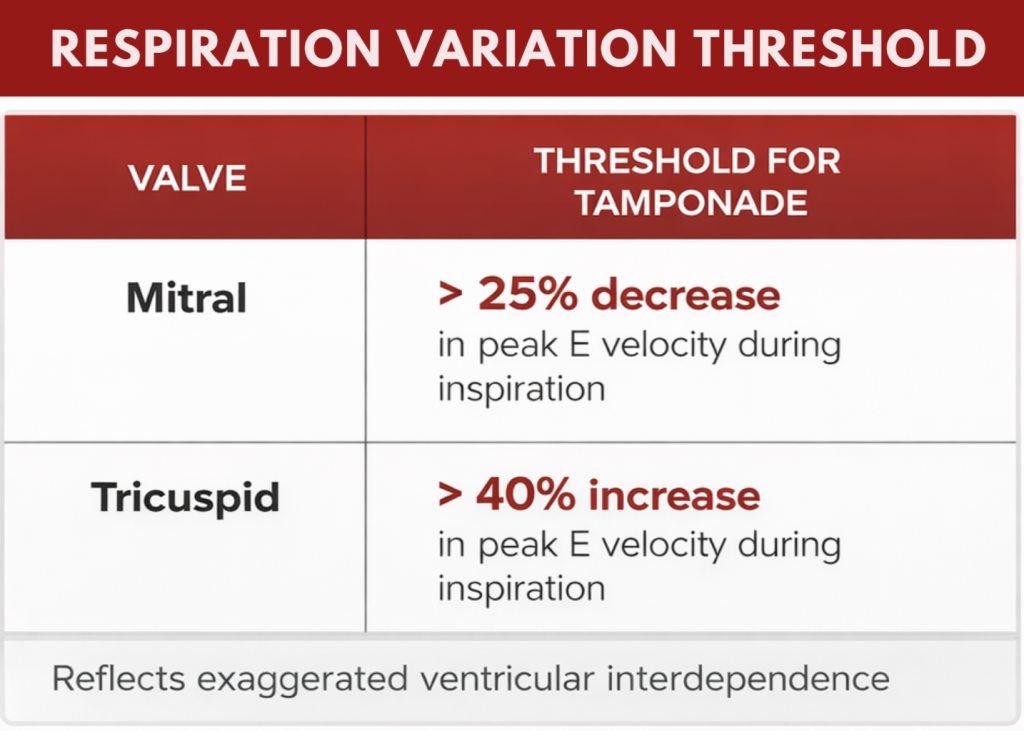 respiratory variation echo pericardial effusion