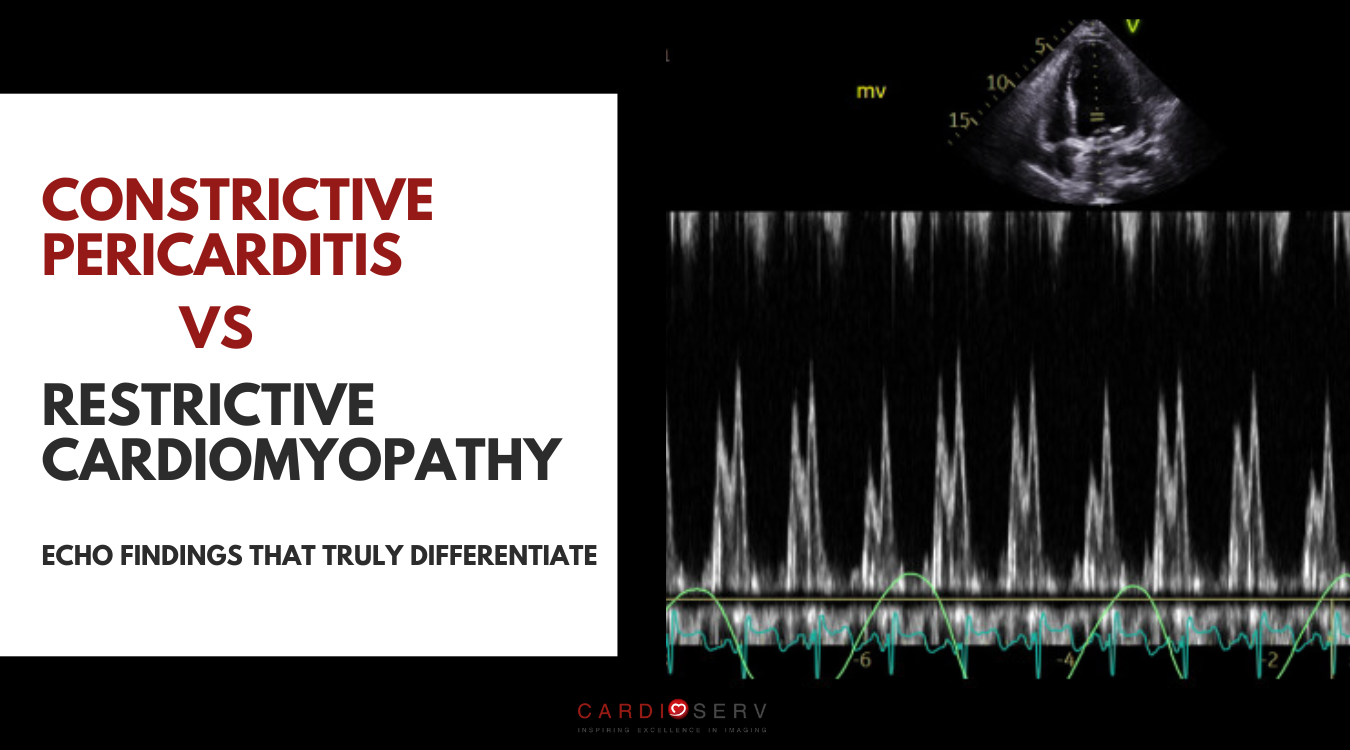 constrictive pericarditis vs restrictive cardiomyopathy