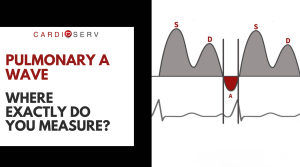 where to measure pulmonary A wave