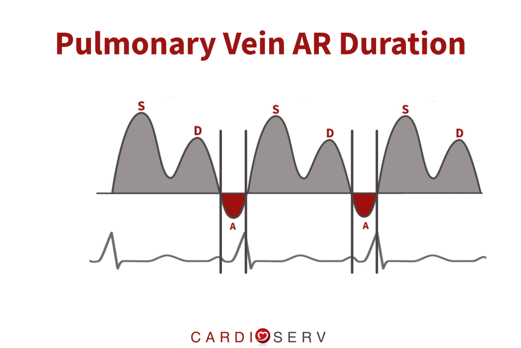 pulmonary vein AR duration where to measure
