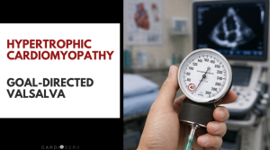 goal-directed valsalva device for HCM LVOT obstruction echocardiography